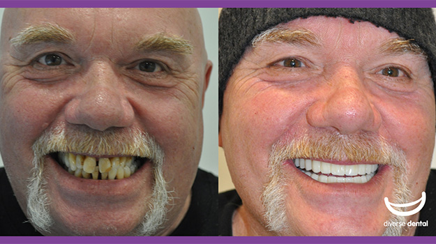 oral-rehabilitation-dentist-koo-wee-rup.jpg